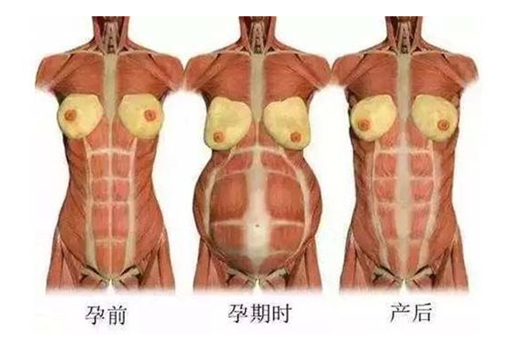 產(chǎn)后媽媽骨盆修復(fù)――帶你回到完美身材！