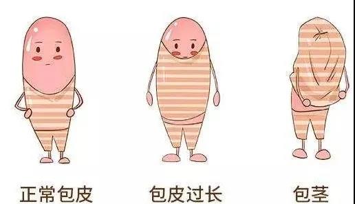 【保山安利醫(yī)院】家長(zhǎng)速看！暑期包皮手術(shù)預(yù)約正當(dāng)時(shí)！