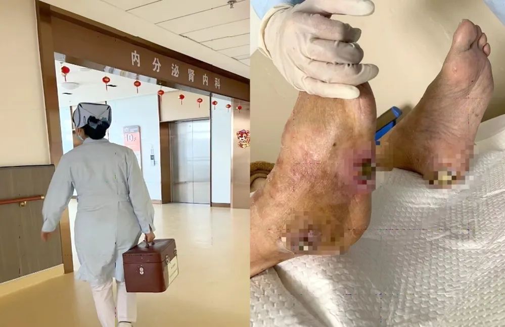 【保山安利醫(yī)院】傷口治療一站式，健康生活零距離！